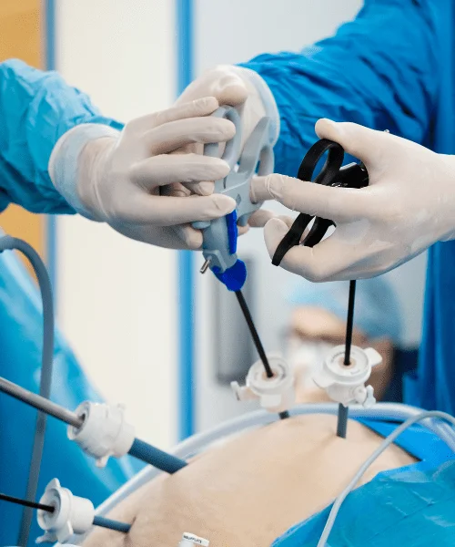Minimally invasive spine surgery